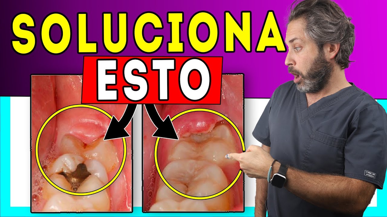 como desinflamar la encia de la