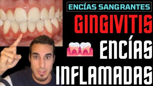 como curar la gingivitis